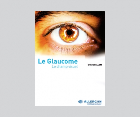 La Glaucome – le champ visuel – Allergan