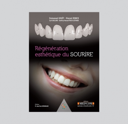 Régénération esthétique du sourire