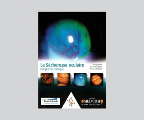 La Sécheresse oculaire – Bausch & Lomb